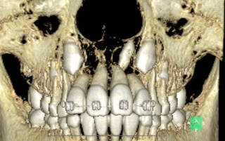 CT-P1.jpg