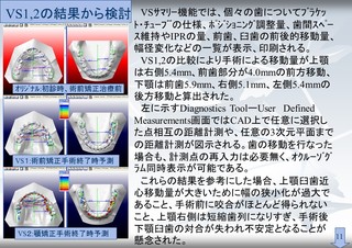 XCh5.JPG