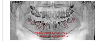 クリックで拡大表示します