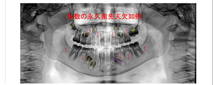 クリックで拡大表示します