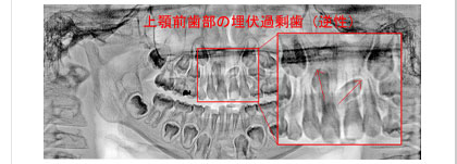 クリックで拡大表示します